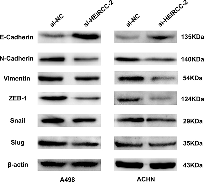 The expression of EMT related proteins were measured by western blot analyses after transfection.