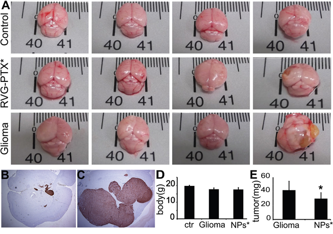 Mice were sacrificed at 4 weeks to evaluate the brain size and weight, and histopathological changes.