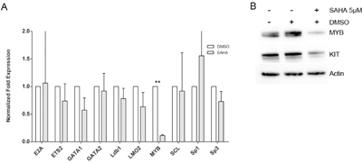 SAHA effects on transcription factors.