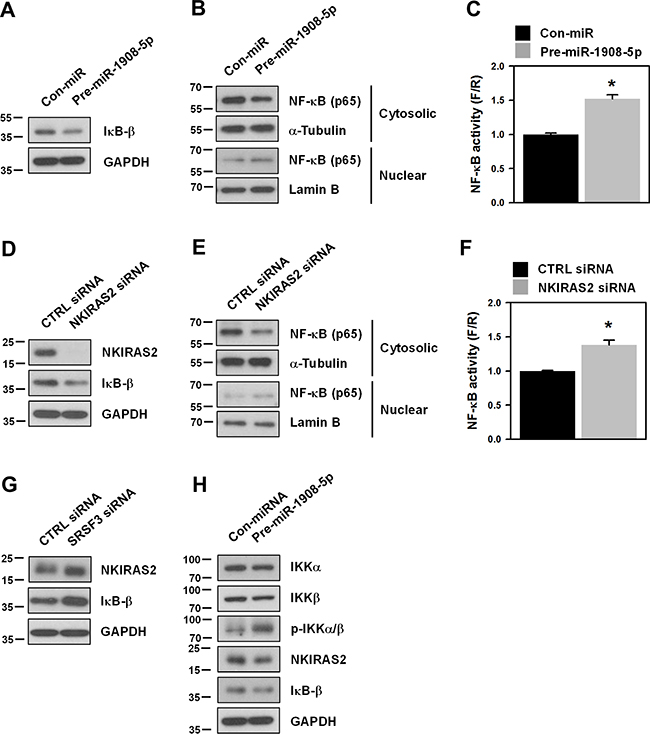 Downregulation of NKIRAS2 by miR-1908-5p is implicated in the oncogenic functions of SRSF3.