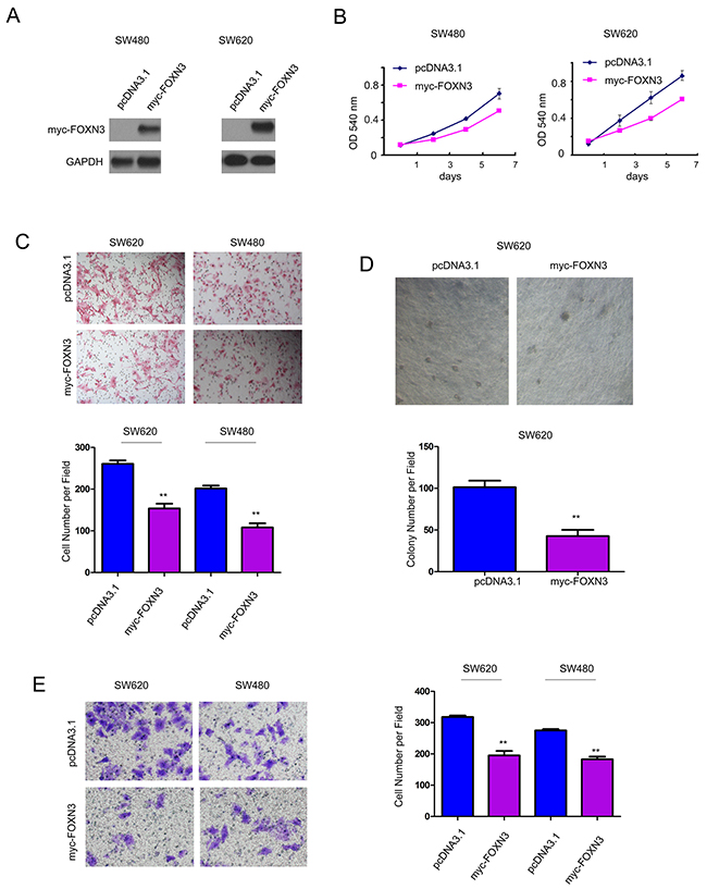 Forced expression of FOXN3 inhibited the growth, migration and invasion of colon cancer cells.
