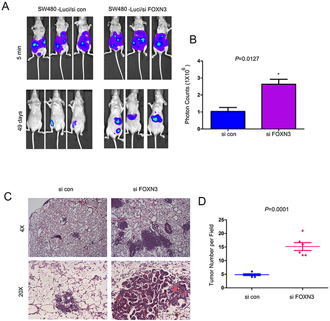 Knocking down the expression of FOXN3 promoted the metastasis of colon cancer cells.