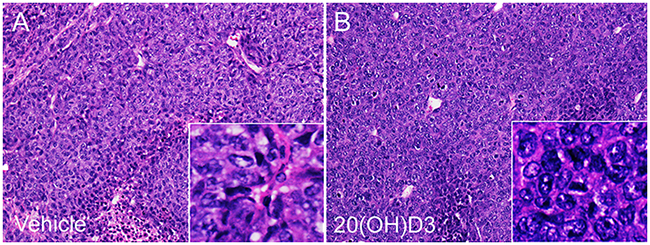 Histology of the implanted tumors.