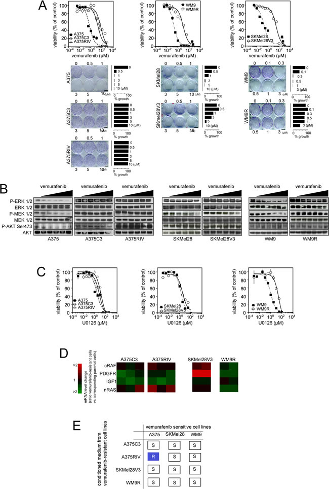 Generation of melanoma models of vemurafenib acquired resistance mediated through diverse mechanisms.