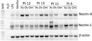 Nectin-4 and Nectin-1 are expressed in human mesothelial cells and ovarian cancer patient samples.