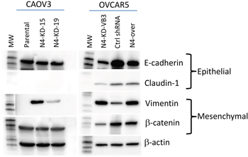 Alterations in Nectin-4 levels affect expression of EMT markers.