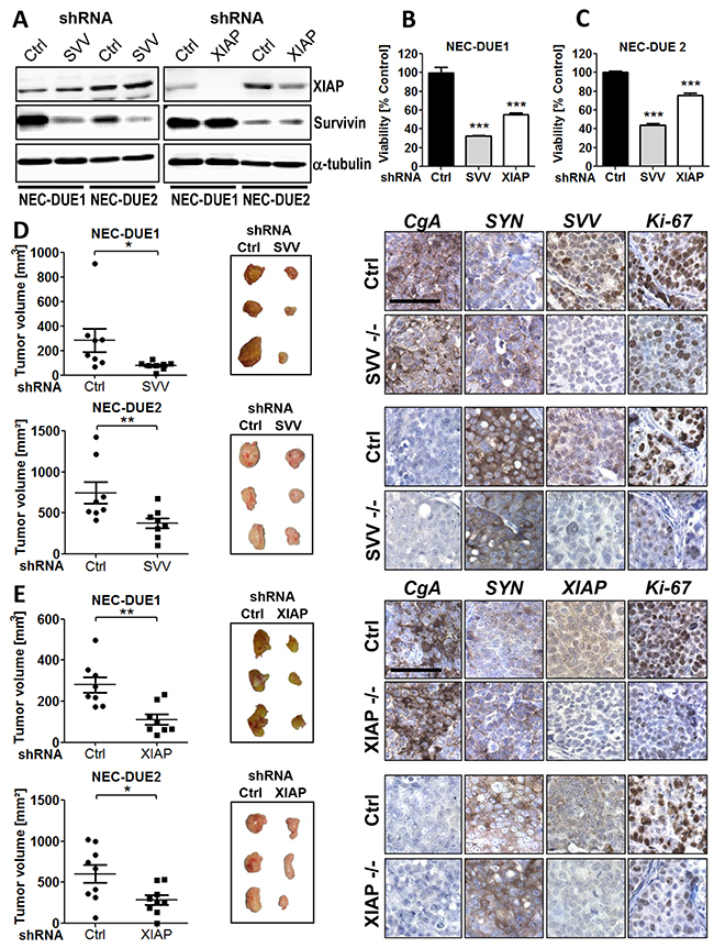 Knockdown of survivin or XIAP impairs growth of GEP-NEC cells both in vitro and in vivo.