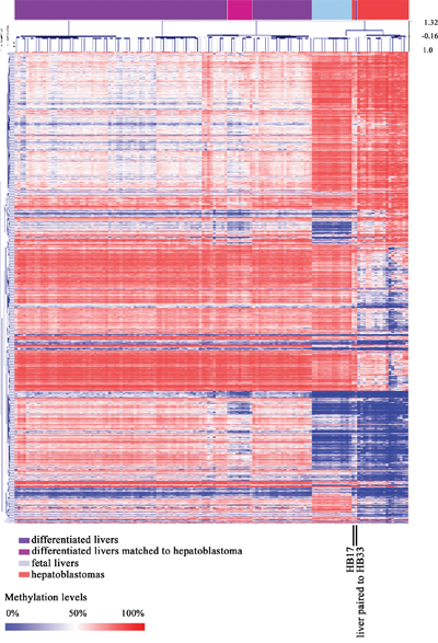 Methylation pattern of combined sample sets from this study (hepatoblastoma and control livers) and Bonder et al, 2014 (fetal and adult liver samples).