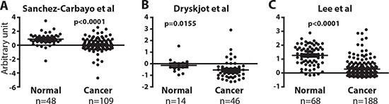 ERα mRNA expression is reduced in bladder tumors.