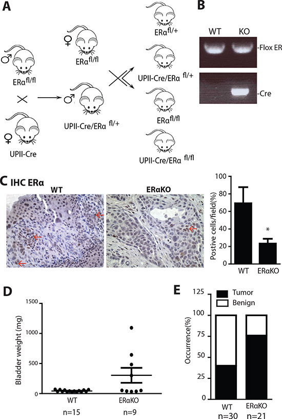 Urothelial specific ERα gene knockout increased the cancer incidences in BBN induced BCa model.