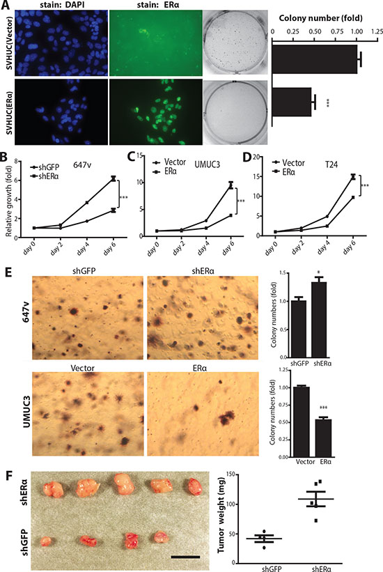 ERα inhibits carcinogen-induced cell malignant transformation and BCa cell growth.