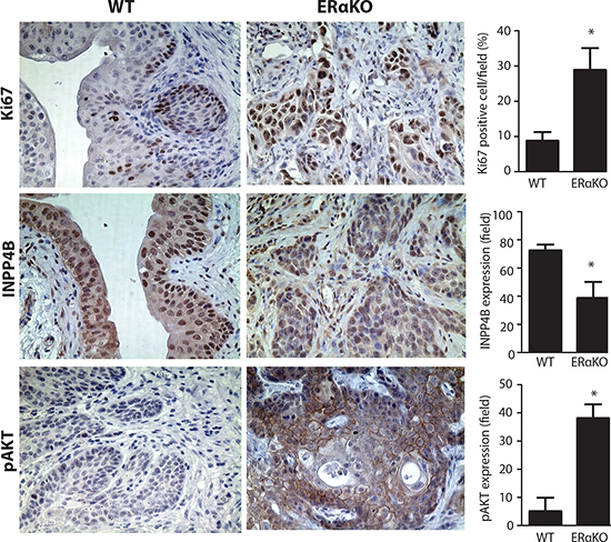 Reduced INPP4B and pAKT expression in BBN treated mouse BCa tissues.