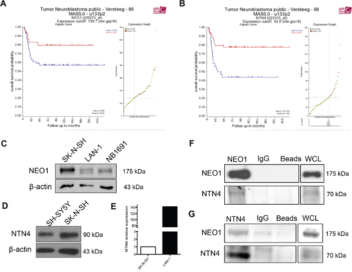 Clinical significance of NEO1 and NTN4 expression and characterization of NB cell lines.