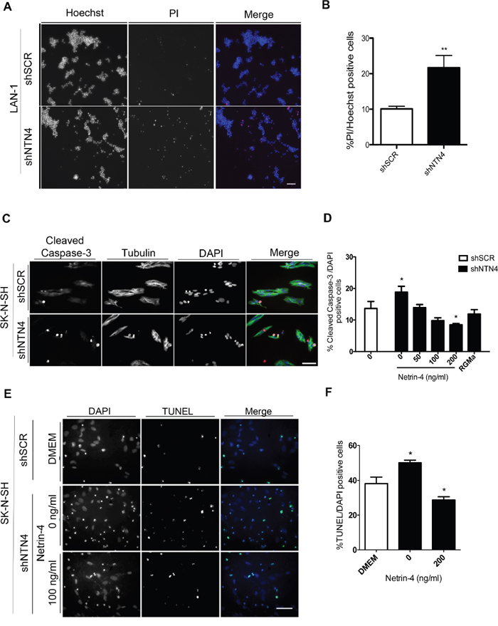 Silencing of NTN4 increases apoptosis in NB cells; exogenous Netrin-4 decreases this effect.
