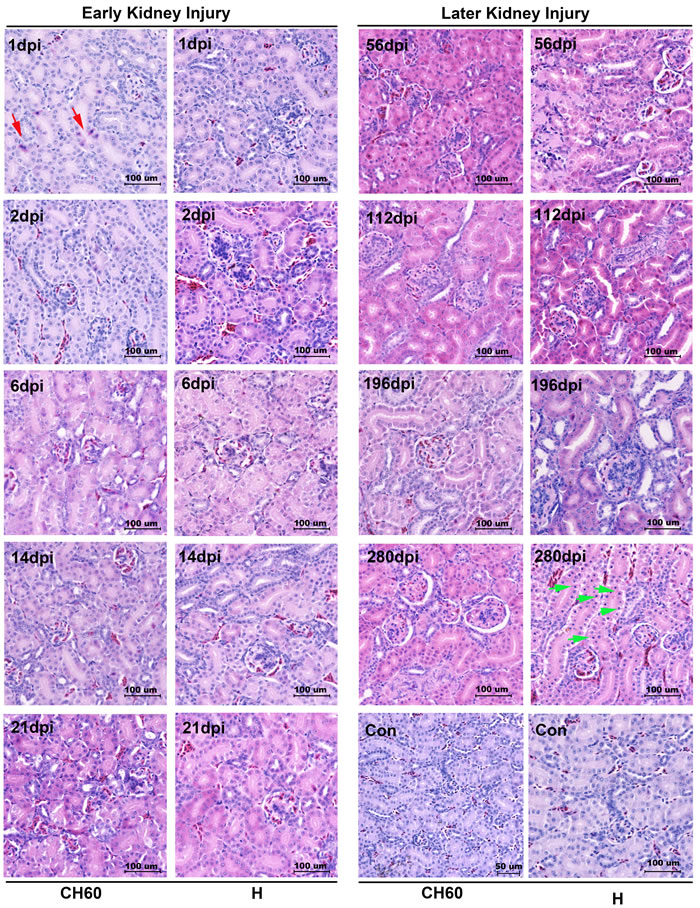 Microscopic lesions in kidney infected with the DHAV-1 H strain and CH60 strain.
