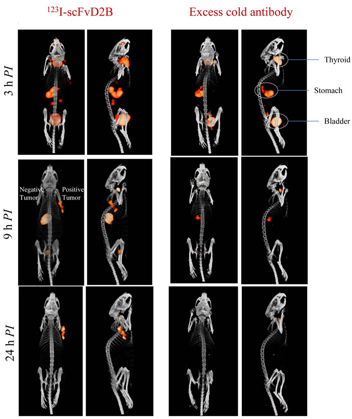 Representative SPECT/CT images in LS174T-PSMA/LS174T model after intravenous administration of