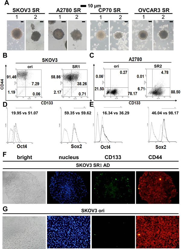 Morphology and stemness properties of ovarian cancer cell spheroids.