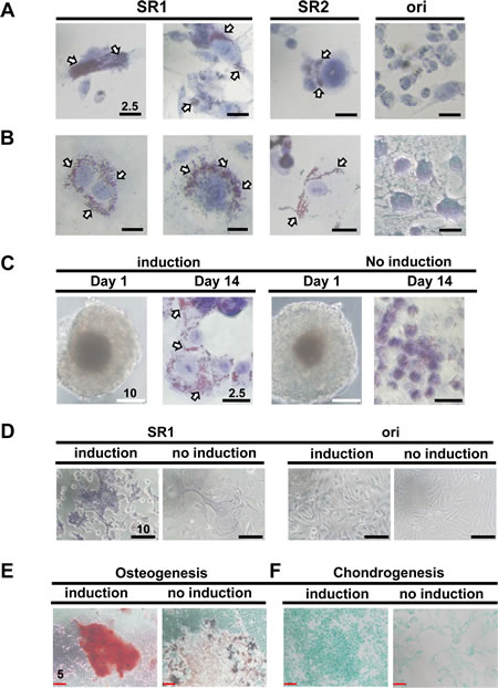 SR1 cells derived from various ovarian cancer cell lines show multiple differentiation potency.