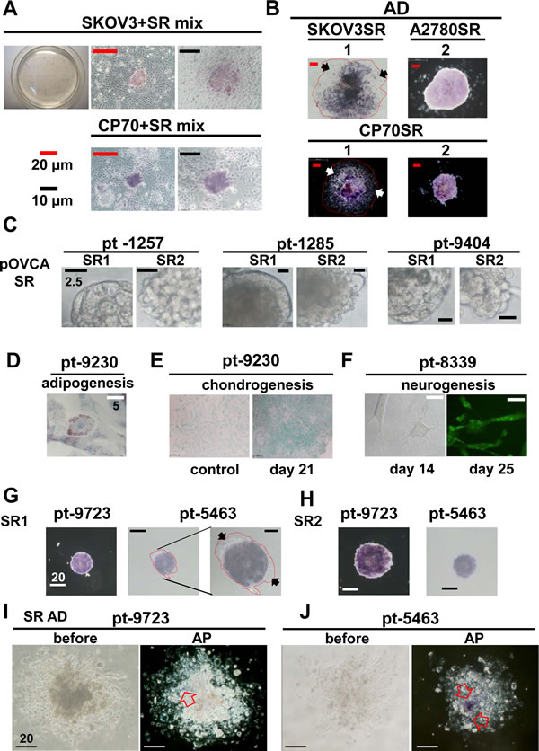 Stemness-associated marker ALP increased in spheroid cells derived from ovarian cancer cell lines and patients&#x2019; tissues.