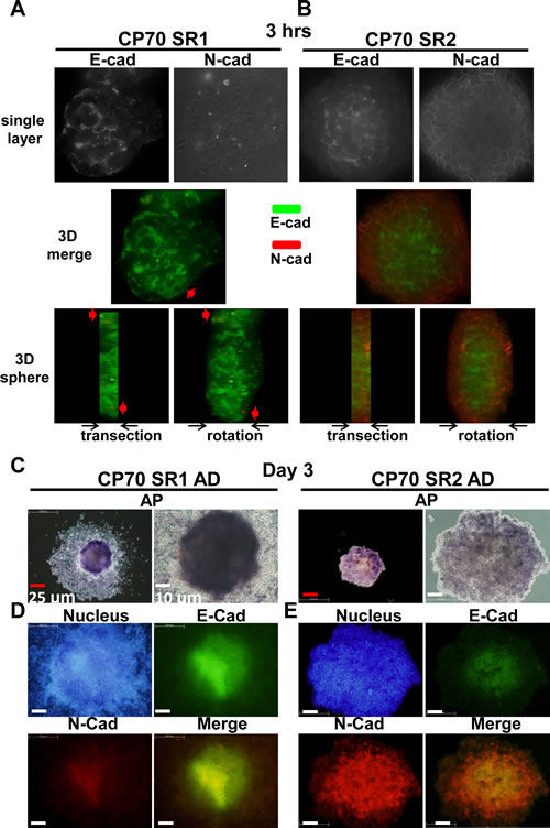 Differences in ALP activity and expression of E-cadherin (E-cad) and N-cadherin (N-cad) between SR1 and SR2 cells.