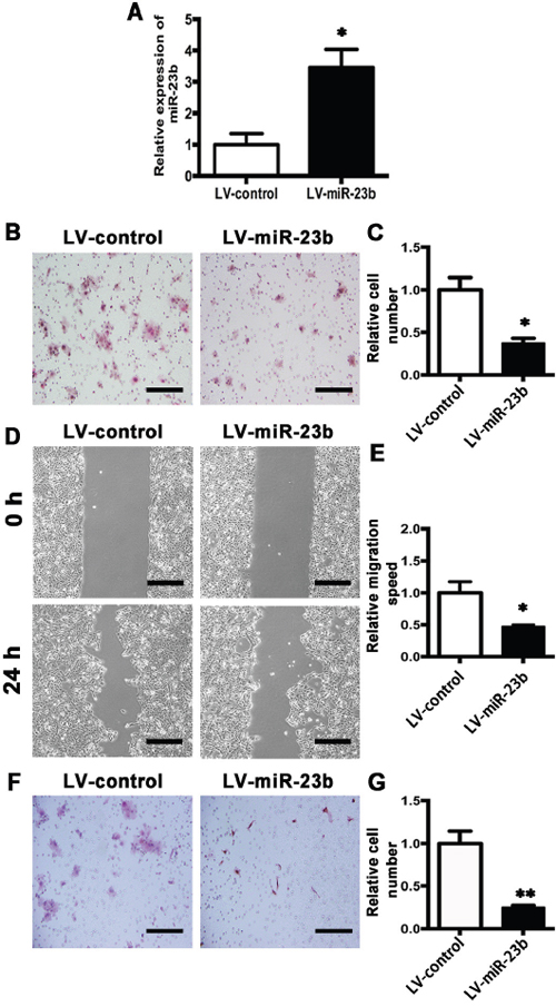 MiR-23b overexpression inhibits migration and invasion abilities of SCC15 cells.