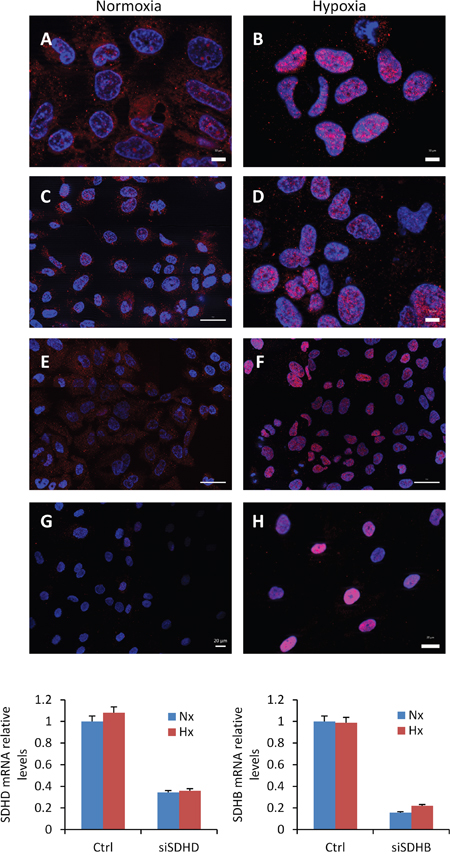 Absence of HIF-1&#x03B1; protein accumulation in nuclei of cells treated with SDHB or SDHD-siRNAs.