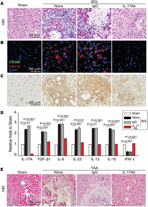 Neutralization of IL-17A resolved BDL or TAA-induced acute or chronic inflammation in hepatic tissue.