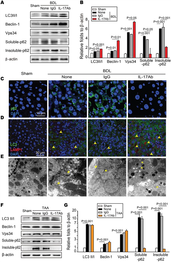 Neutralization of IL-17A restored BDL or TAA-induced autophagy suppression in hepatic tissue.