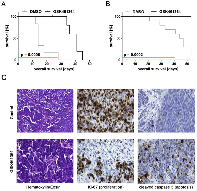 GSK461364-mediated PLK1 inhibition exerts antitumoral activity against human neuroblastoma xenografts in mice.
