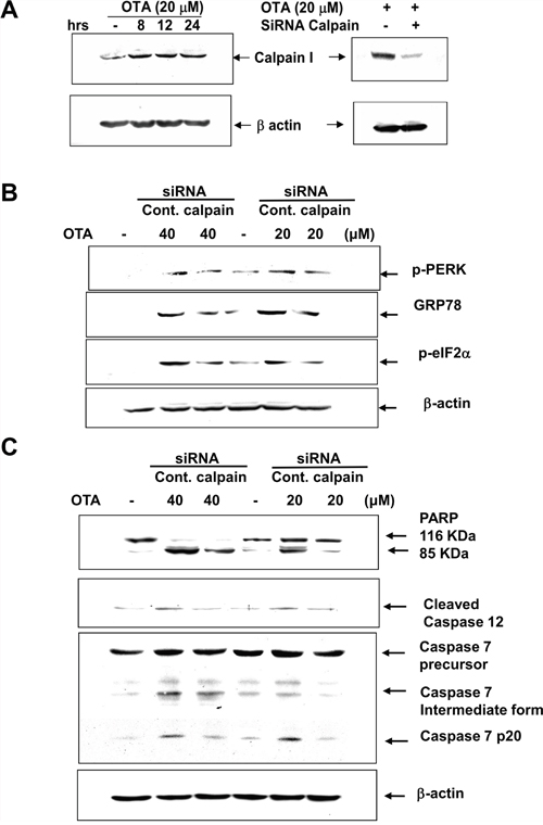 Transfection of calpain siRNA inhibited OTA-induced ER Stress and proapoptotic markers.