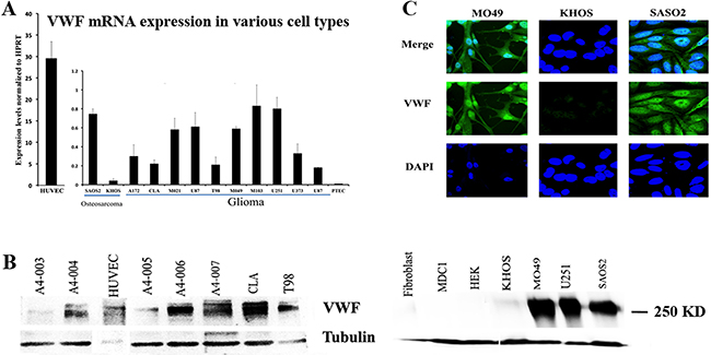 VWF is expressed in some cancer cell lines of non-endothelial origin.