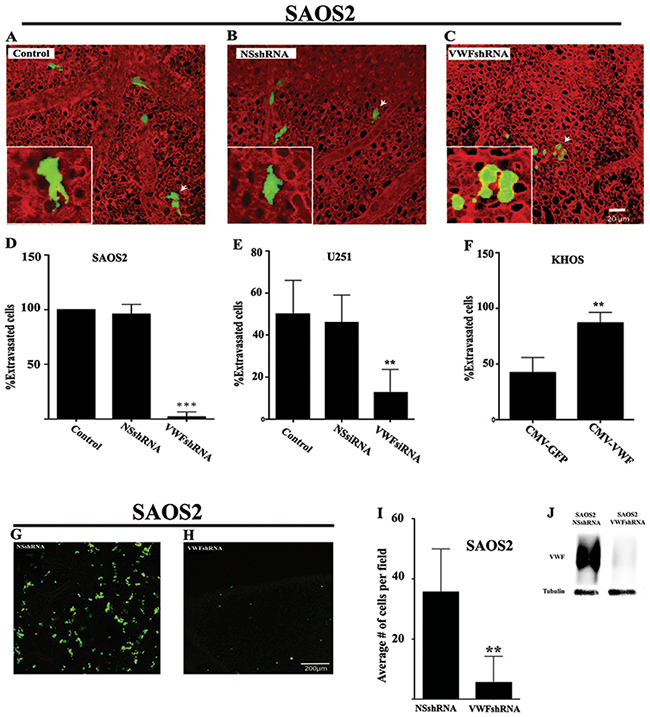 VWF expression by cancer cells results in enhanced extravasation.