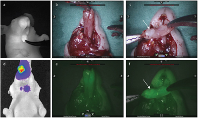 Fluorescence-guided robotic tumor imaging and dissection: Imaging from the same animal with a large tumor in the anterior tongue and bilateral neck metastasis as seen on BLI. d.