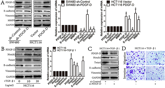 PDGF-D induces the EMT profile in CRC cells.