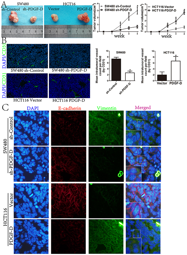 PDGF-D promotes tumorigenesis, angiogenesis and EMT profile of CRC cells in vivo.