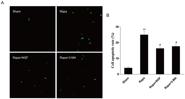 NGF protected H9C2 cells from rapamycin-induced apoptosis.