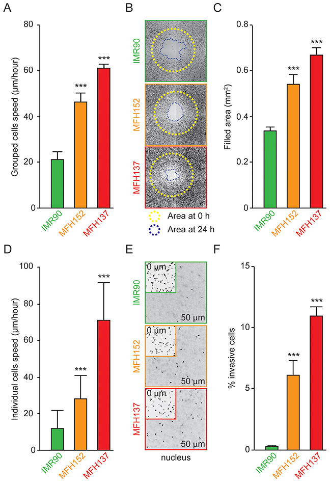 MFH137 and MFH152 sarcoma cell lines have a great invasive and motile potential.