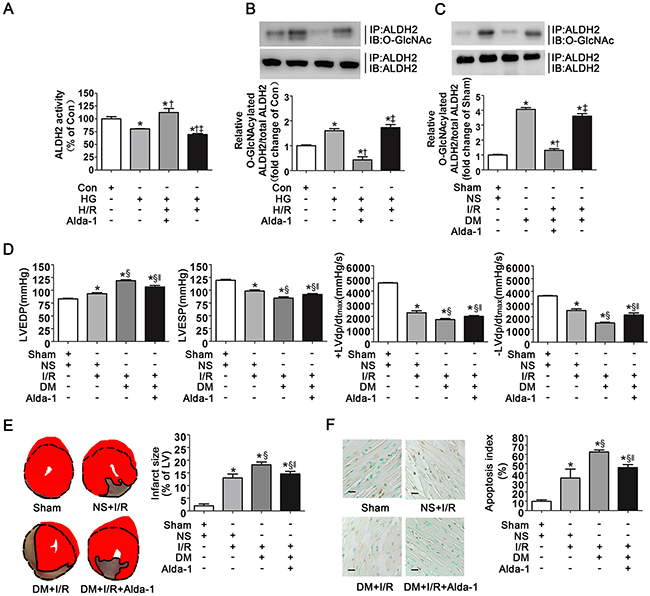 Alda-1 decreased ALDH2 O-GlcNAc modification and improved myocardial ischemia/reperfusion injury exacerbated by hyperglycemia.