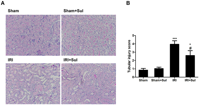 Sulodexide pretreatment mitigated renal histological injury in IRI rats.