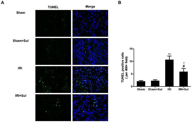 Renal apoptosis was mitigated in sulodexide-administered IRI rats.