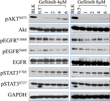 Gefitinib inhibits EGFR phosphorylation but induces STAT3 activation in lung caner cells.