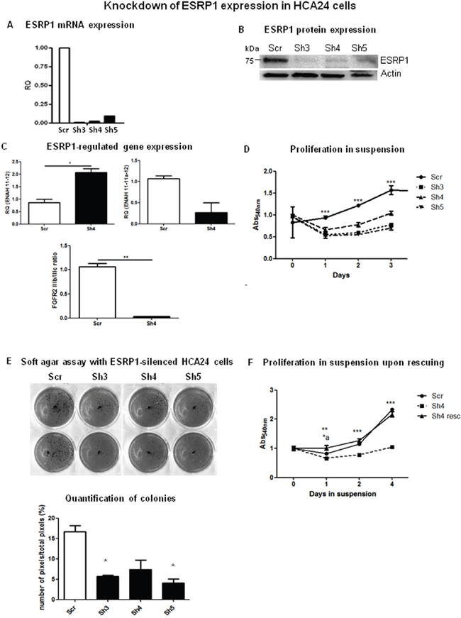 ESRP1-silencing reduces tumorigenicity of CRC cells.