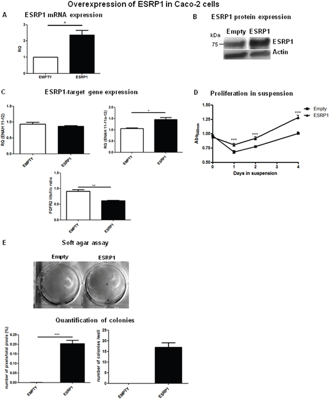 ESRP1 overexpression promotes proliferation and transformation of Caco-2 cells.