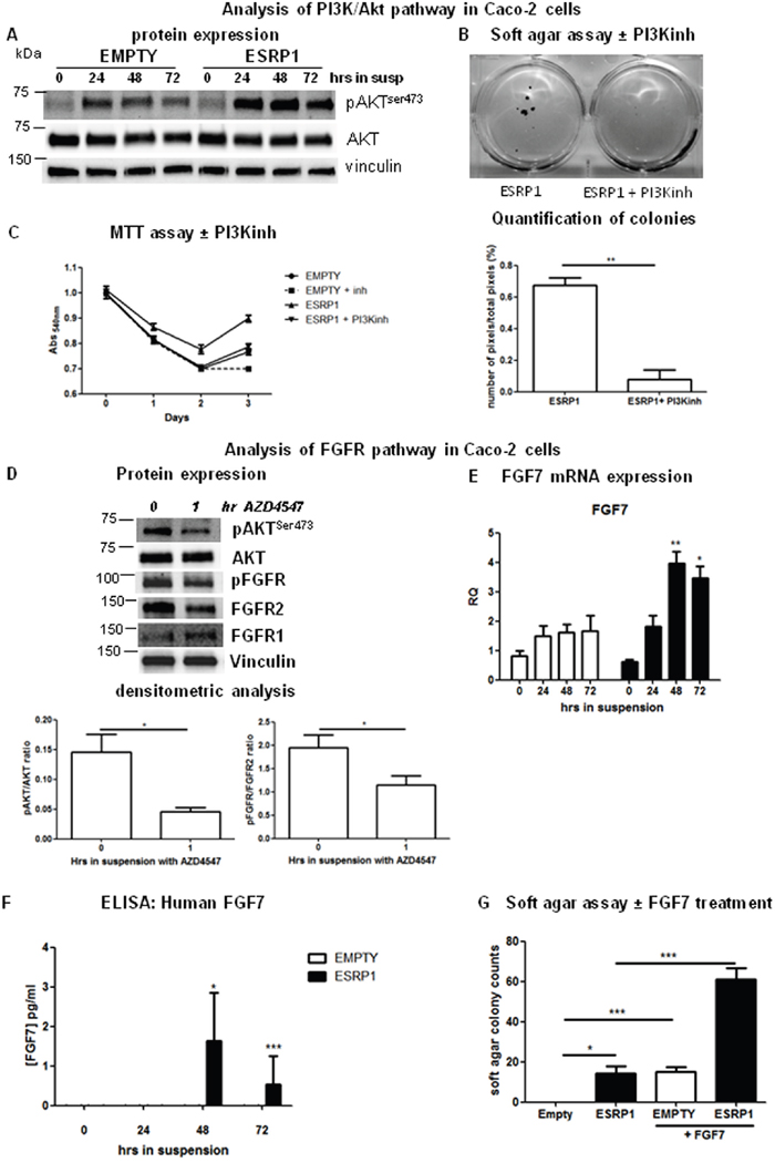 Pathways involved in ESRP1-driven CRC cell transformation.