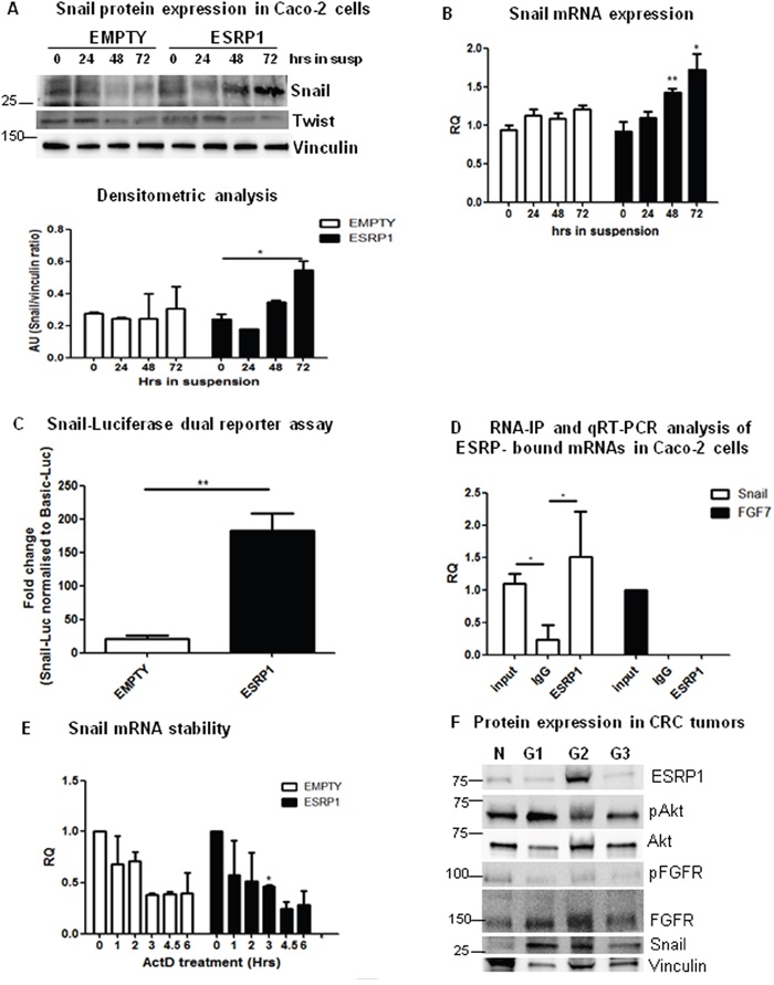 ESRP1 overexpression induces Snail expression and enhances metastasis formation.