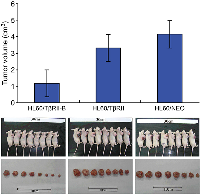 Growth of HL60/T&#x03B2;RII and HL60/T&#x03B2;RII-B cells in BALB/c nude mice 22 days post-inoculation.