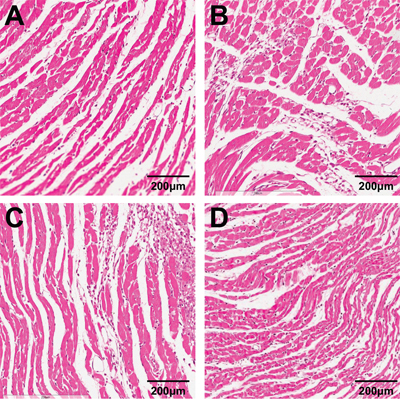 Morphological observation of the myocardial tissue of rats in the cardiac hypertrophy, low-dose tanshinone IIA, high-dose tanshinone IIA and control groups (&#x00D7; 400).