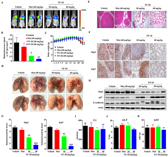 In vivo anti-lung cancer efficacy of YF-18.