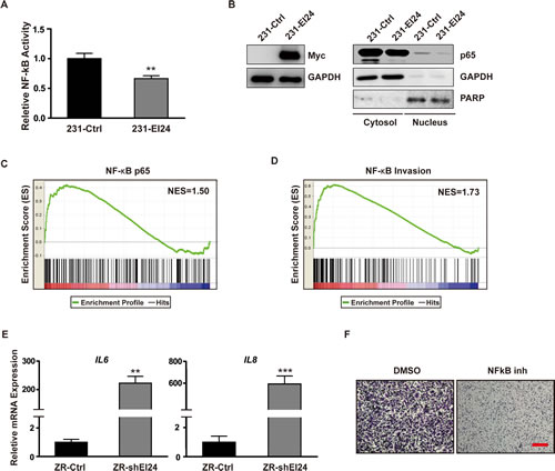 NF-&#x3ba;B activation and upregulation of genes involved in inflammation-induced tumor progression by EI24 knockdown.