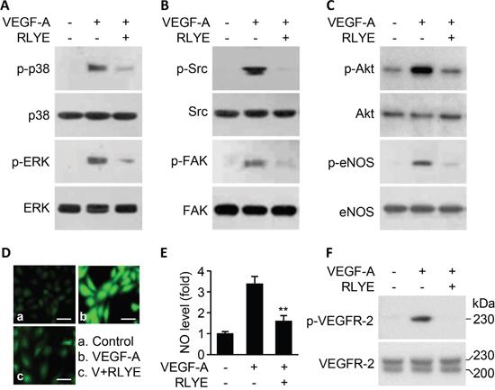 RLYE inhibits VEGF-A-induced angiogenic signal cascades.